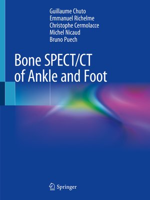 cover image of Bone SPECT/CT of Ankle and Foot